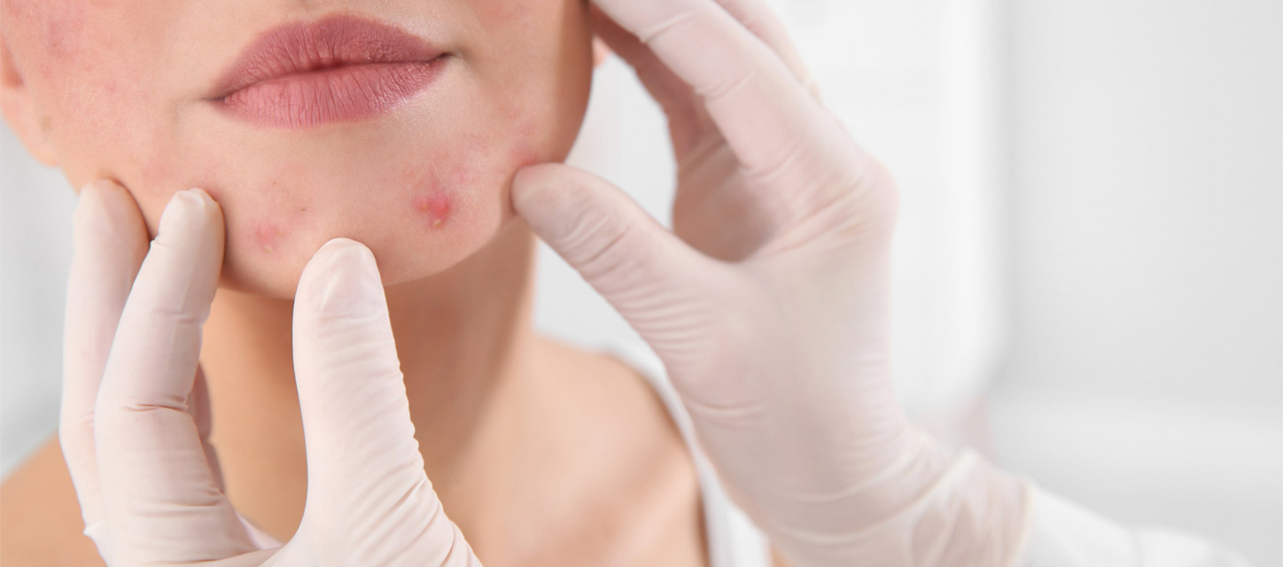 Ready to start treatment?