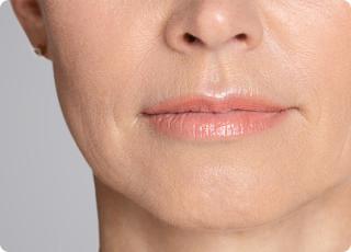 Mature Skin