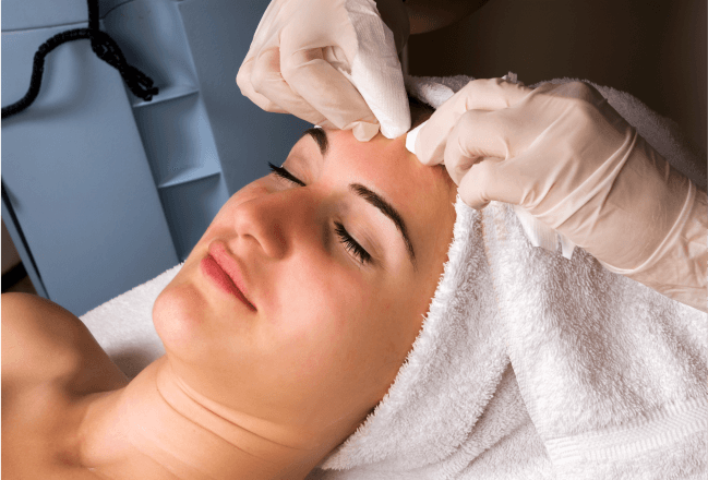 Acne Treatment